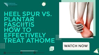 Heel Spur vs. Plantar Fasciitis: How to Effectively Treat at Home