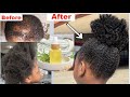 Use this once a week and your hair will never stop growing | SECRET HAIR GROWTH RECIPE. FAST ACTING