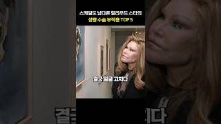 스케일도 남다른 헐리우드 스타의 성형 수술 부작용 TOP 5