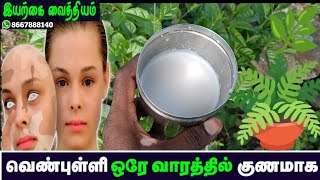 வெண்புள்ளிக்கு நிரந்தர தீர்வு | Venpulli Natural Treatment