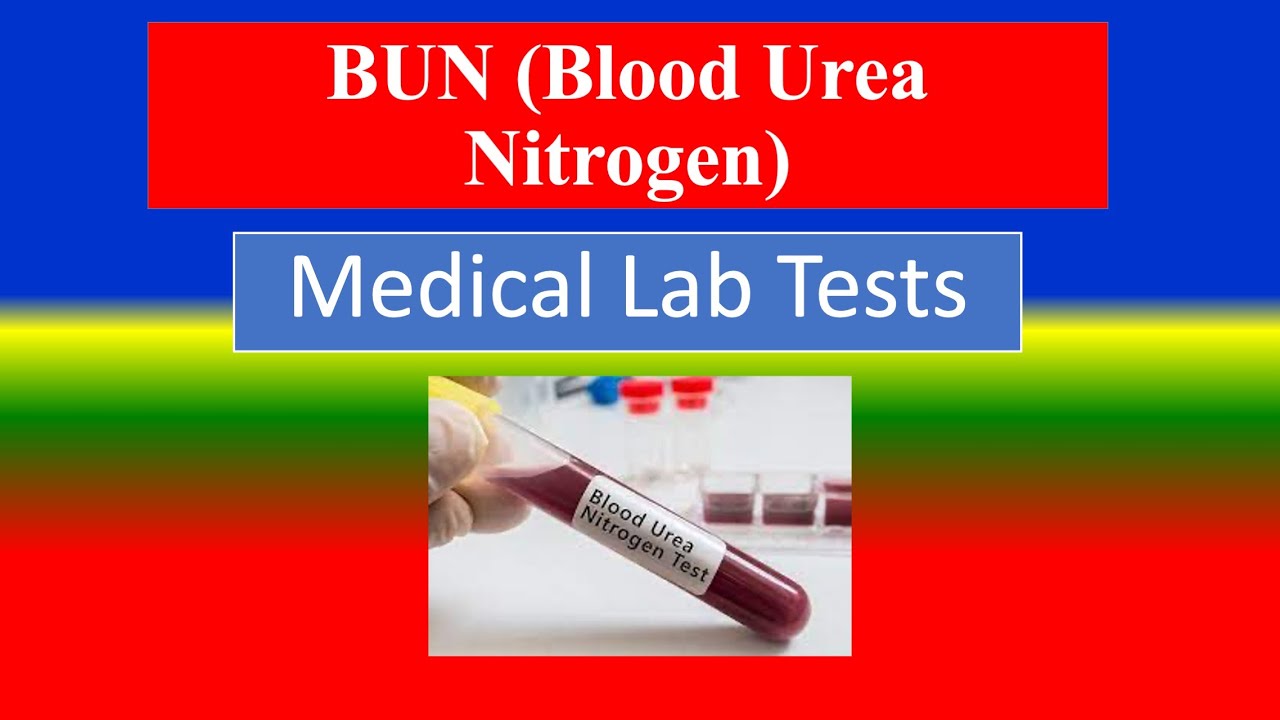 (BUN) Blood Urea Nitrogen. Test - - Lab Tests - What Is ? , Uses ...