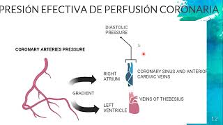 Presión Efectiva de Perfusión Coronaria- Dr. Valderrama