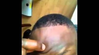 British man mad over his hairline