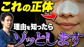 【角栓＝取るもの？】ほとんどの人が知らない！医師が教える正しい5種類の毛穴ケア【角栓/黒ずみ/いちご鼻】