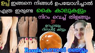 കണ്ടാൽ ആരും കൊതിക്കുന്ന കൈകാലുകൾ ലഭിക്കാൻ ഉപ്പ് ഇങ്ങനെ ഉപയോഗിക്കൂ/#SkinWhiteningHomeRemedy