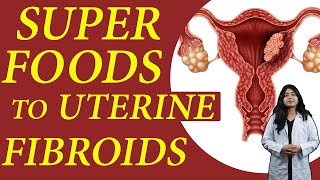 Best Fruits & Vegetable to UTERINE FIBROIDS | Food to Avoid For Fibroids in Hindi | Dr. Mahima