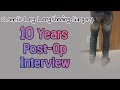 Cosmetic Leg Lengthening Surgery Post-op 10 years