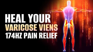 Heal Your Varicose Veins | Enhance Proper Blood Flow In Arms Hands \u0026 Legs | 174 Hz Pain Relief