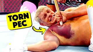 Doctor Reacts To Painful WWE Injuries