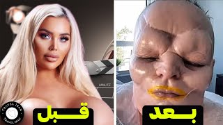 باور نمیکنین این سلبریتی ها با جراحی زیبایی با خودشون چیکار کردن...!