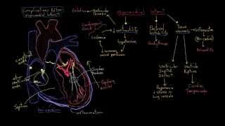 Khan Academy - Complications Post-Myocardial Infarction