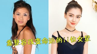 靠整容改变命运的女星，杨颖爱情事业双丰收，第7位沦为柜台货员