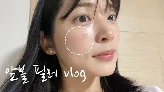 앞볼 필러 맞기 vlog | 언박싱하는 일상