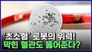 '초소형' 로봇의 위력! 막힌 혈관도 뚫어준다? | 브라보 K-사이언티스트 [반복재생]/YTN 사이언스