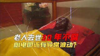 88歲老人去世30年不腐不爛，傷口能自動愈合，心電圖顯示異常波動