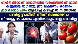 ഈ പഴം തിളപ്പിച്ചു കഴിച്ചാൽ നിങ്ങൾക്ക് ഹാർട്ട് അറ്റാക്കിൽ നിന്നും രക്ഷപ്പെടാം|