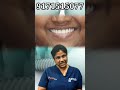 implant முழு fixed பல் செட் பழைய பற்களின் சிரிப்பு vs புதிய முழு பற்கள் சிரிப்பு shorts