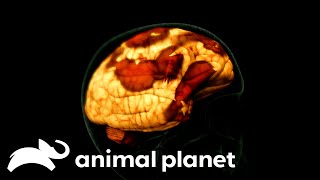 Deathly Parasite Attacks A Toddler's Brain | Monsters Inside Me | Animal Planet