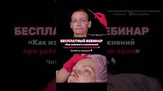 💉 Ссылка на вебинар по БТА в зоне лба в описании канала #ботулинотерапия #бта #ботулотоксин