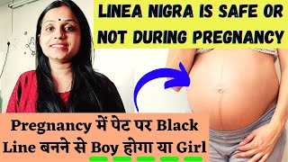 Is it Safe? Linea Nigra Duing Pregnancy ~गर्भावस्था में नाभि पर line बनने से पता करे बेटा है या बेटी
