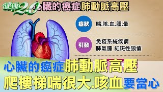 爬樓梯喘很大竟是肺高壓 平均存活率只2.8年 健康2.0