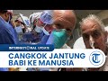 Sosok Dokter yang Berhasil Lakukan Cangkok Jantung Babi ke Manusia, Jadi yang Pertama di Dunia