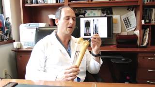 LIMB LENGTHENING with DR. ROZBRUCH - Pre-Op Education (INTERNAL LENGTHENING ROD)