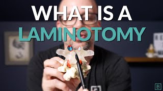 What is a Laminotomy? | Spine Surgery Basics