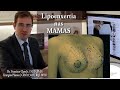 LIPOENXERTIA - Aumento das mamas com gordura | Dr. Francisco Claro Jr.