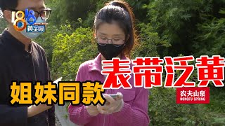 【1818黄金眼】好姐妹想戴同款，表带泛黄是何原因