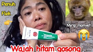 Wajah mendadak gosong dan hitam karena krim apotik!wajib tahu