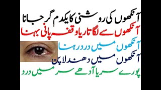 Eye watering, pain, weakness, half blindness treatment / انکھوں کی روشنی کا علاج Ankhon ki  Kamzoori