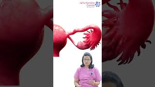 ఎండోమెట్రియోసిస్ మరియు ఫెర్టిలిటీ || Do Endometriotic cyst Stops Pregnancy? || Jata Fertility Centre