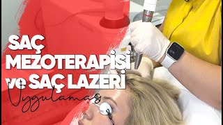 Saç Mezoterapisi ve Saç Lazeri Uygulaması  I Dr. Ferda Karataş