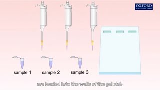 الفصل الكهربائي الهلامي Gel electrophoresis