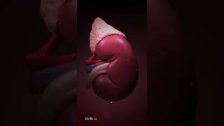 What Could Cause Kidney Stones (Animation)