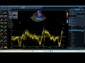 IQ 217 TV E' TVI MEASUREMENT ECHOPAC ANALYSIS ECHOCARDIOGRAPHY