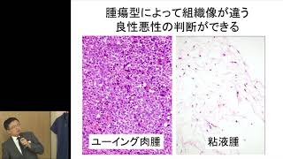 【第27回　希少がん Meet the Expert：肉腫(サルコーマ)～診断～】講演　吉田 朗彦【国立がん研究センター希少がんセンター】