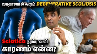 வயதானவர்களுக்கு வரும் முதுகு எலும்பு வளைவு Scoliosis நரம்பு அழுத்தம் தவிர்ப்பது எப்படி?