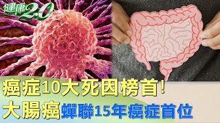 癌症10大死因榜首! 大腸癌蟬聯15年癌症首位 健康2.0