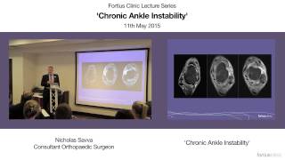 Chronic Ankle Instability