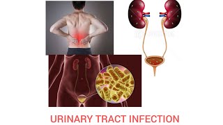 URINARY TRACT INFECTION""Introduction, cause, symptoms, types, diagnosis.#shorts #youtube