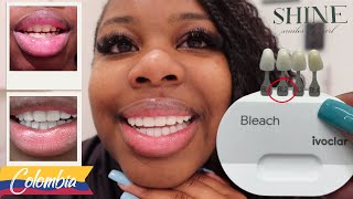 Colombia Solo Trip: Getting Porcelain Veneers at Shine Smiles, BL2 Shade (VLOG)