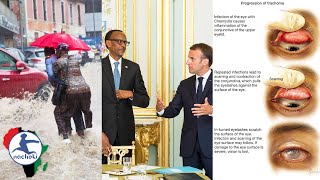 Angola Heavy Rains Kill, France Accomplice to Rwanda Genocide, Gambia Eliminates Eye Disease