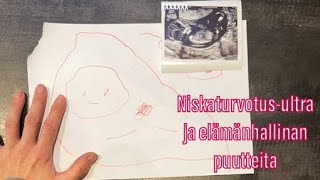 Tulihan se ultra-aika 😊 Sikiön terveys pistää äidin arvomaailmaa uusiksi || Arkivlog