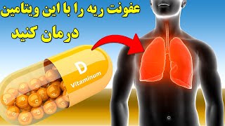 عفونت های ریوی را با ویتامین دی درمان کنید,Treatment of lung infection with vitamin D