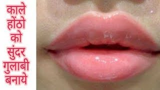 काले होठों को सुंदर और गुलाबी बनाए (100% Working Remedy) Get Pink Lips at home