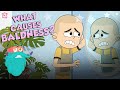 What Causes Baldness? | Causes Of Hair Loss | The Dr Binocs Show | Peekaboo Kidz