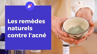 Les remèdes naturels contre l'acné