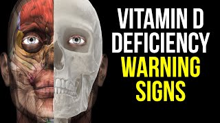 10 Signs of Vitamin D Deficiency to Never Ignore